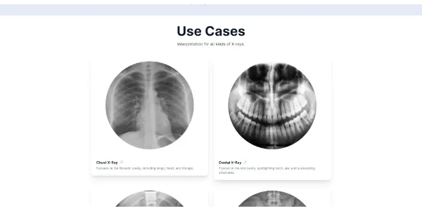 X-ray Interpreter AI